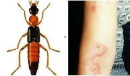 昆虫学者皮肤最新爆料蓝皮,蓝皮昆虫的神秘生成之谜